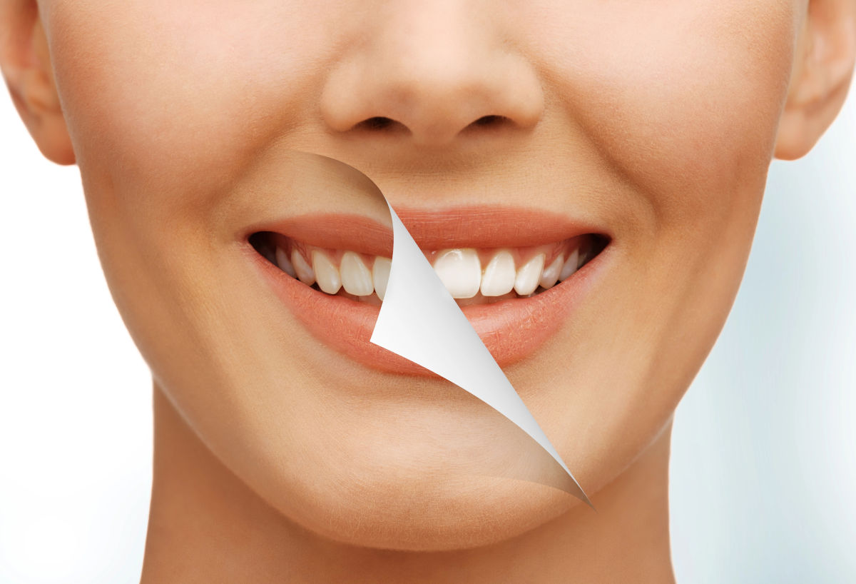 Are Whitening Strips Bad for Your Teeth