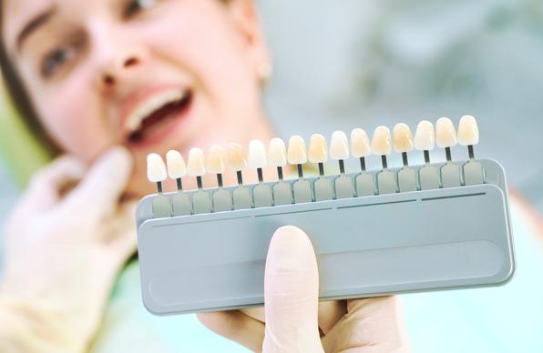 How Long Teeth Whitening Lasts